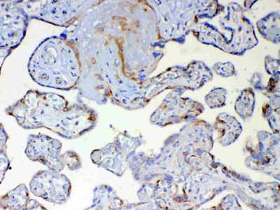 2 - Anti-DYNLT1 Picoband Antibody ABO13047