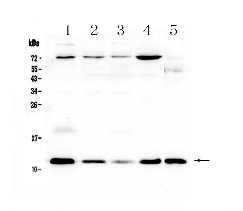 1 - Anti-DYNLT1 Picoband Antibody ABO13047