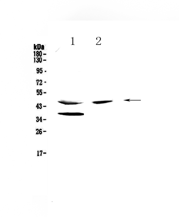 1 - Anti-Carboxypeptidase A Picoband Antibody ABO13048