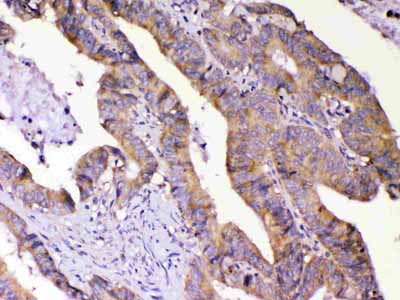 2 - Anti-AMD1 Antibody ABO13049
