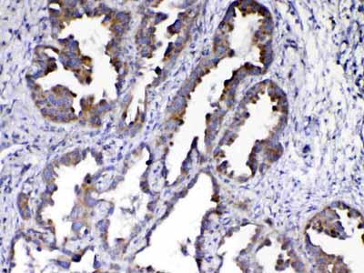 2 - Anti-AMD1 Antibody ABO13049