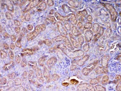 2 - Anti-AMD1 Antibody ABO13049
