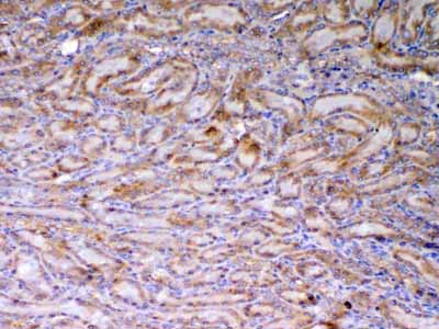 2 - Anti-AMD1 Antibody ABO13049