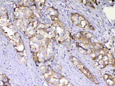 2 - Anti-AMD1 Antibody ABO13049