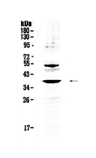 1 - Anti-AMD1 Antibody ABO13049