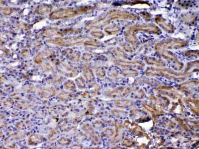 2 - Anti-NOV/CCN3 Picoband Antibody ABO13050