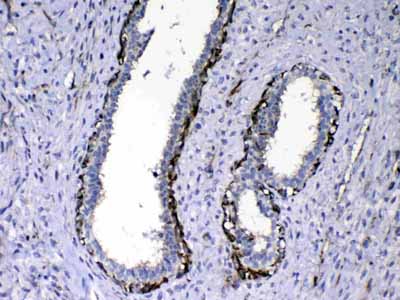 2 - Anti-NOV/CCN3 Picoband Antibody ABO13050