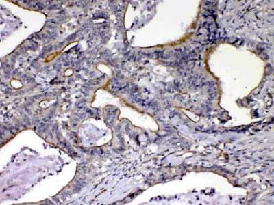2 - Anti-NOV/CCN3 Picoband Antibody ABO13050