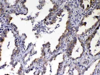 2 - Anti-NOV/CCN3 Picoband Antibody ABO13050