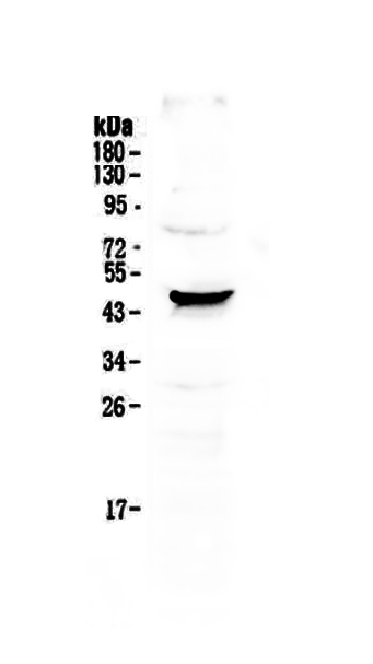 1 - Anti-NOV/CCN3 Picoband Antibody ABO13050