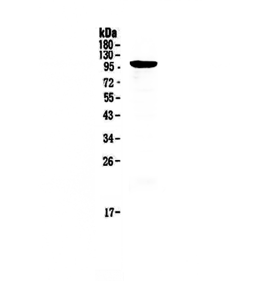1 - Anti-RECK Picoband Antibody ABO13052