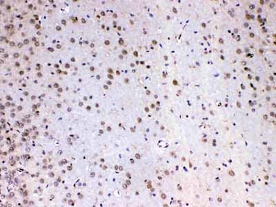 2 - Anti-MED4 Picoband Antibody ABO13053