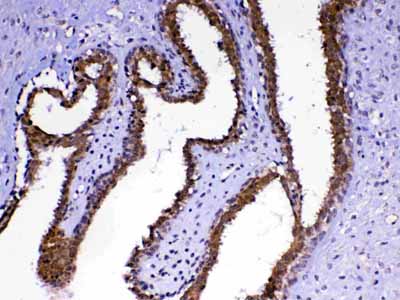2 - Anti-MED4 Picoband Antibody ABO13053