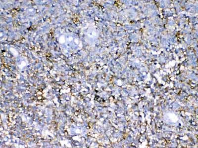 2 - Anti-Neurocan Picoband Antibody ABO13055