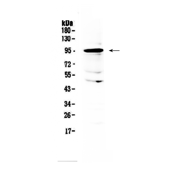 1 - Anti-AMOTL2 Picoband Antibody ABO13056