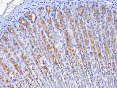2 - Anti-TFF2 Picoband Antibody ABO13057