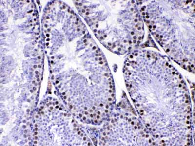2 - Anti-MED8 Picoband Antibody ABO13061