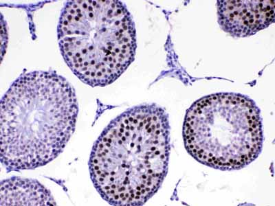 2 - Anti-MED8 Picoband Antibody ABO13061