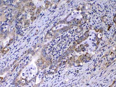 2 - Anti-Relaxin 1 Picoband Antibody ABO13062