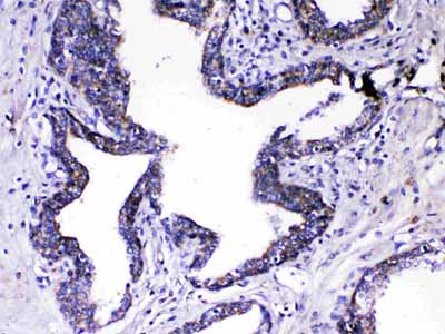 2 - Anti-Relaxin 1 Picoband Antibody ABO13062