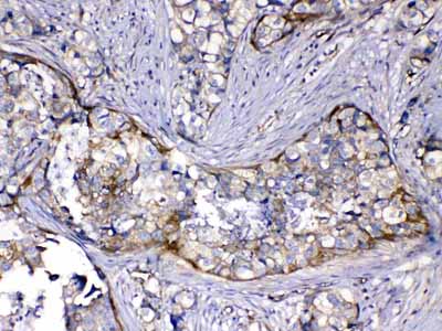 2 - Anti-HOMER3 Picoband Antibody ABO13064