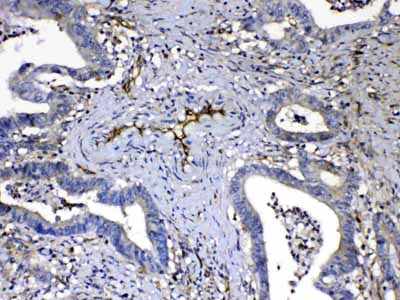 2 - Anti-HOMER3 Picoband Antibody ABO13064