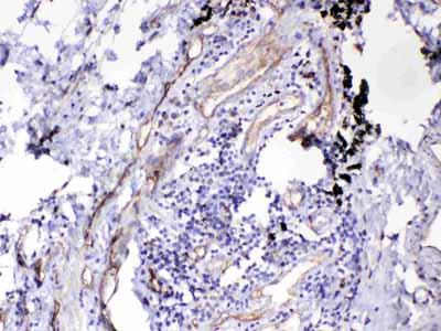 2 - Anti-HOMER3 Picoband Antibody ABO13064