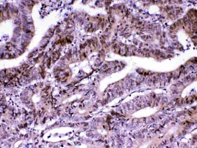 2 - Anti-MED18 Picoband Antibody ABO13075