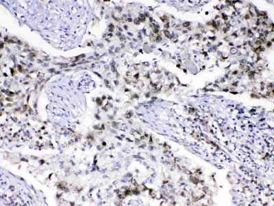 2 - Anti-MED18 Picoband Antibody ABO13075
