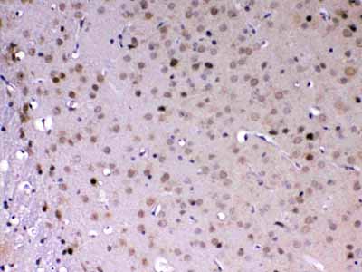 2 - Anti-MED18 Picoband Antibody ABO13075