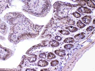 2 - Anti-MED18 Picoband Antibody ABO13075