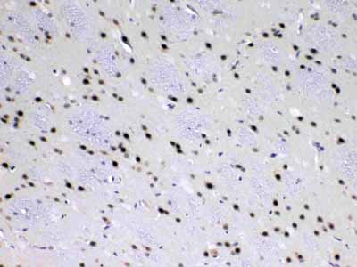 2 - Anti-MED18 Picoband Antibody ABO13075