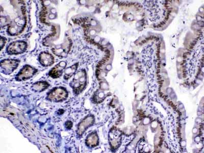 2 - Anti-MED18 Picoband Antibody ABO13075