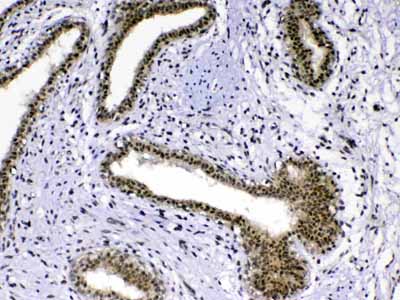 2 - Anti-MED18 Picoband Antibody ABO13075