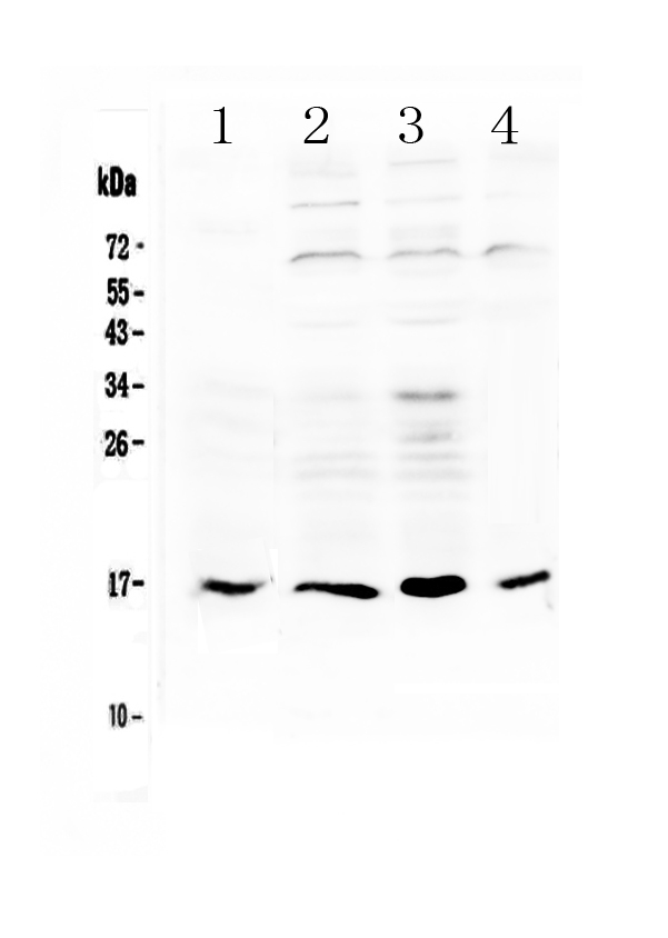 1 - Anti-IL17B Picoband Antibody ABO13076