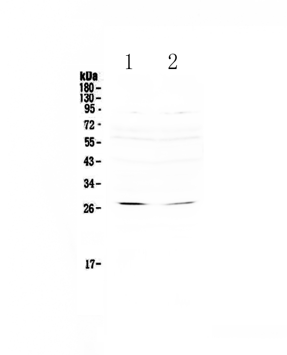 1 - Anti-RNF186 Picoband Antibody ABO13078