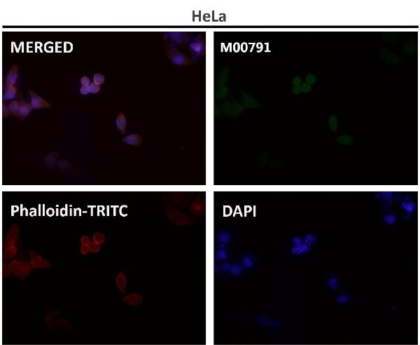 1 - Anti-GSK3 beta Rabbit Monoclonal Antibody ABO13092