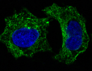 3 - Anti-GSK3 beta Rabbit Monoclonal Antibody ABO13092