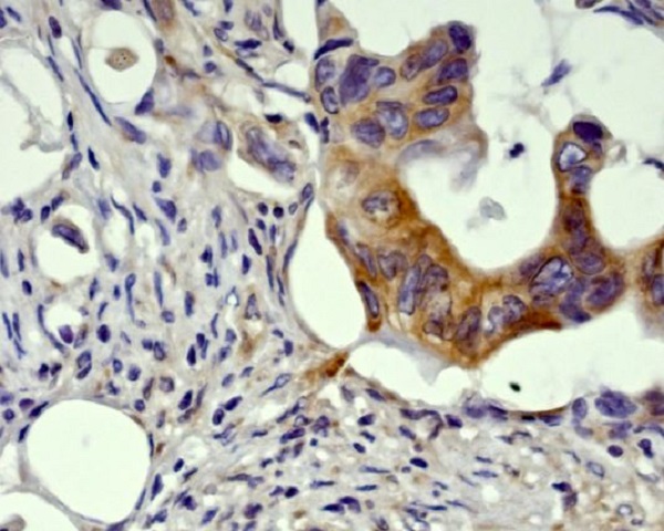 2 - Anti-GSK3 beta Rabbit Monoclonal Antibody ABO13092
