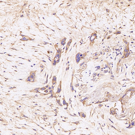2 - Anti-GSK3 beta Rabbit Monoclonal Antibody ABO13092