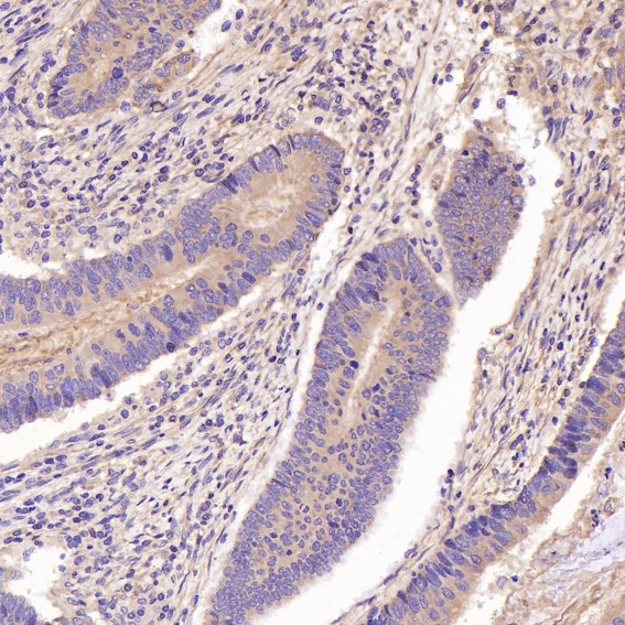 2 - Anti-GSK3 beta Rabbit Monoclonal Antibody ABO13092