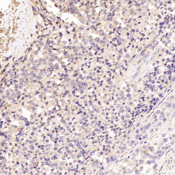 2 - Anti-GSK3 beta Rabbit Monoclonal Antibody ABO13092