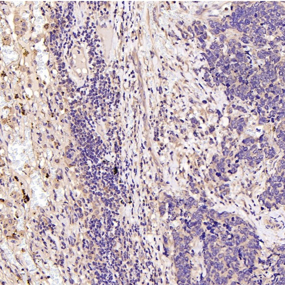 2 - Anti-GSK3 beta Rabbit Monoclonal Antibody ABO13092