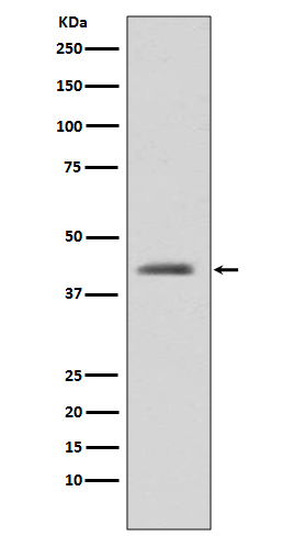 1 - Anti-GSK3 beta Rabbit Monoclonal Antibody ABO13092