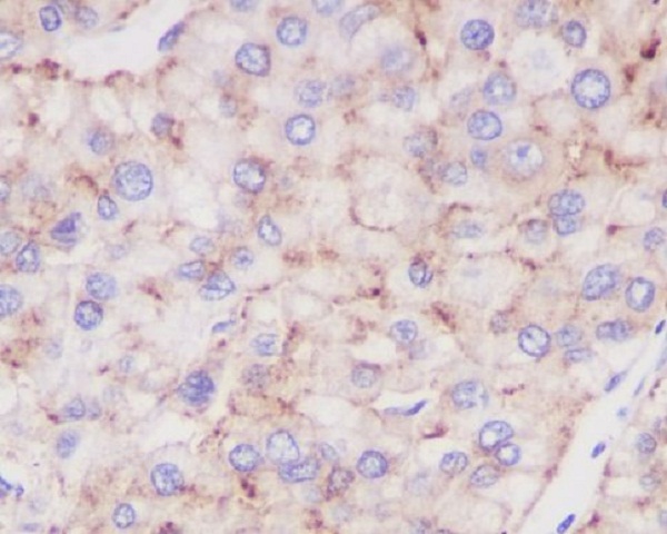 2 - Anti-LAMP2a Rabbit Monoclonal Antibody ABO13093