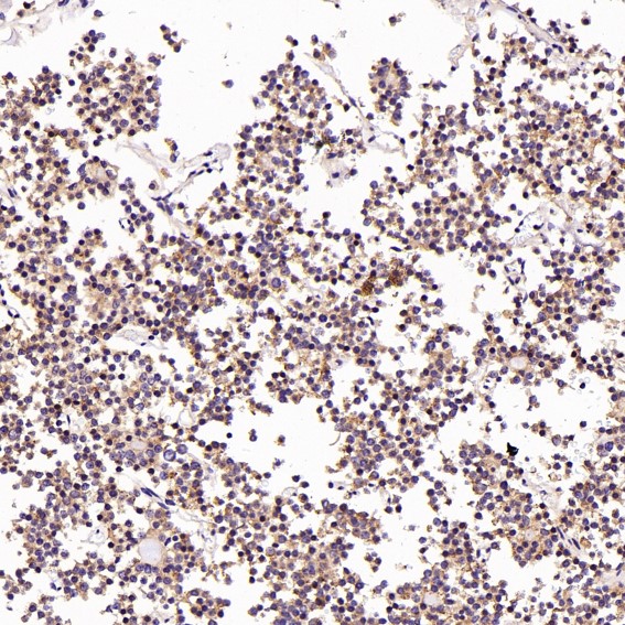 2 - Anti-LAMP2a Rabbit Monoclonal Antibody ABO13093