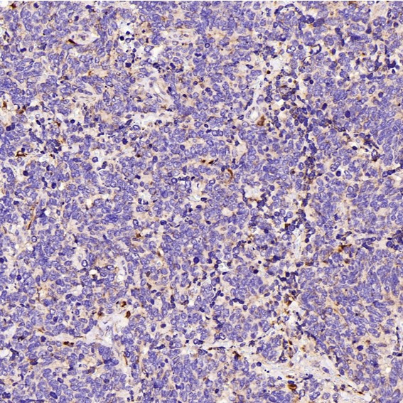2 - Anti-LAMP2a Rabbit Monoclonal Antibody ABO13093