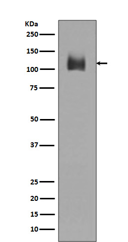 1 - Anti-LAMP2a Rabbit Monoclonal Antibody ABO13093