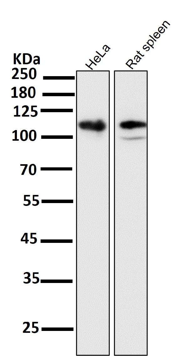 1 - Anti-LAMP2a Rabbit Monoclonal Antibody ABO13093