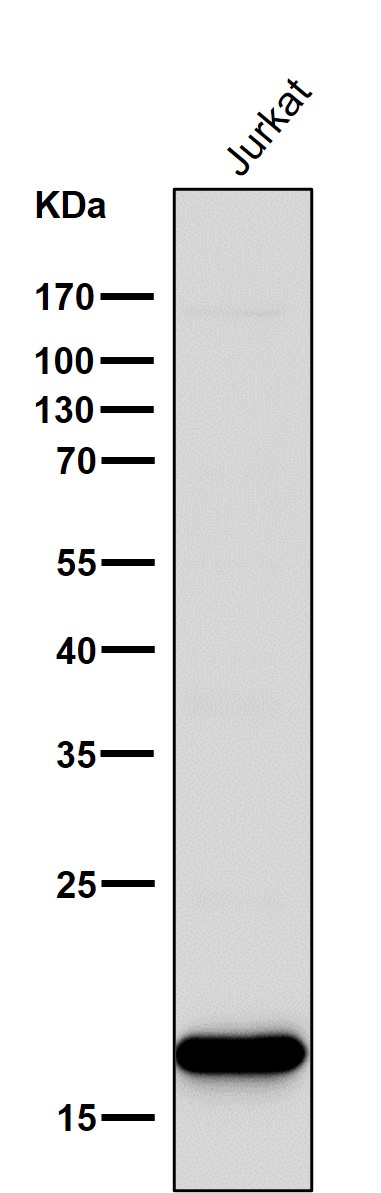 1 - Anti-CD3 zeta CD247 Rabbit Monoclonal Antibody ABO13095
